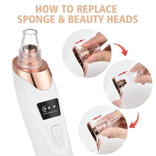 Electric Blackhead Remover Vacuum – Deep Pore Cleaner & Acne Extractor with 5 Suction Heads for Clear, Glowing Skin